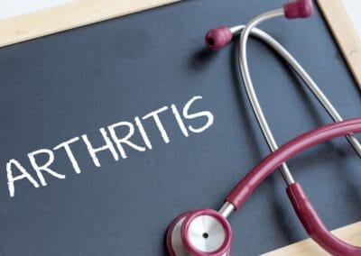 5 Lifestyle Tips to Help You Take Control of Your Rheumatoid Arthritis 