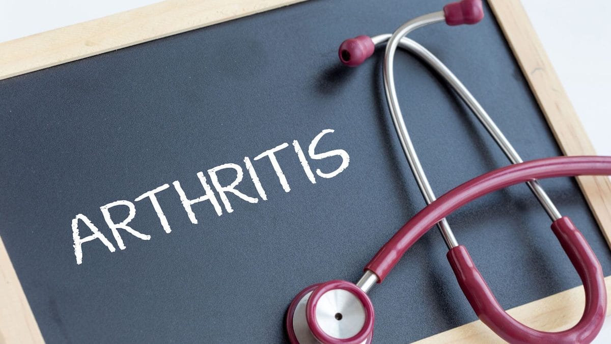 arthritis