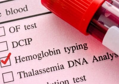 Are You Getting Enough Iron on a Plant-Based Diet? 